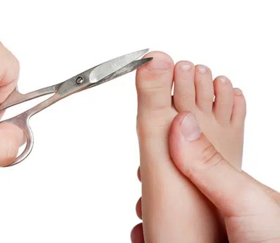 Caring for Your Baby's Fast-Growing Toenails: Preventing and Treating Ingrown Toenails
