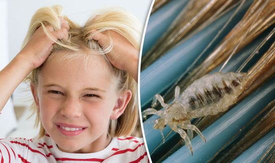 My Child Got Lice at School - Now What?!